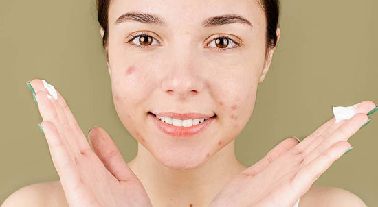 Cremas trtatamiento para el acné juvenil